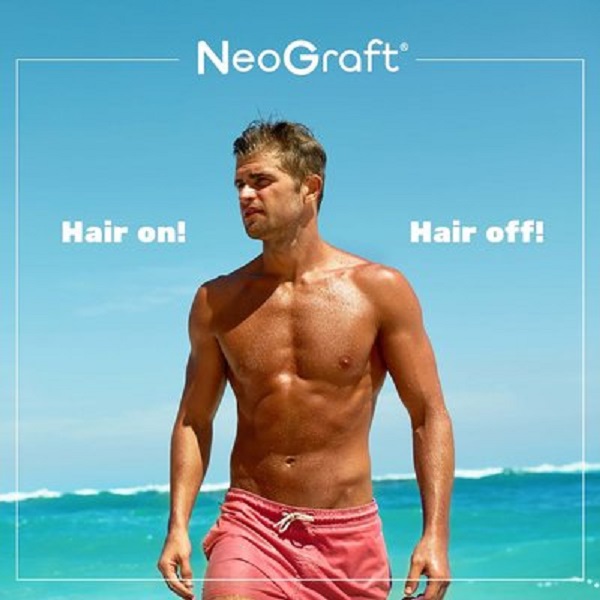 Hair Transplant Orange County Hair Transplant Orange County