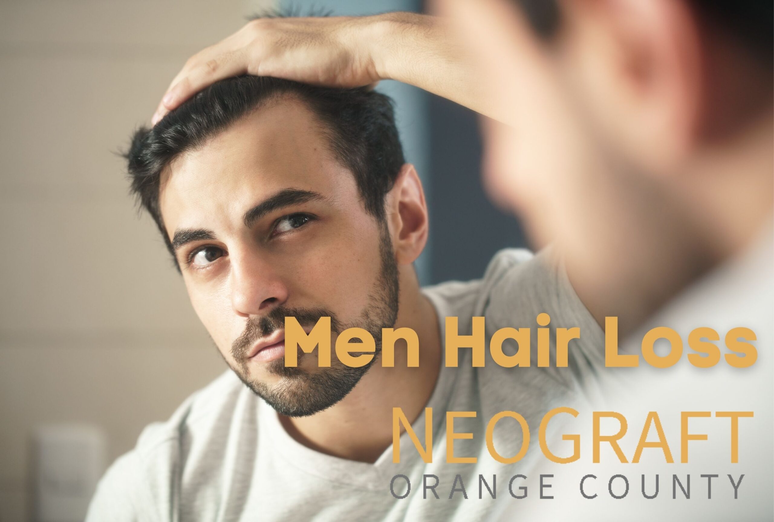 Men Hair Loss Newport Beach