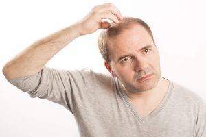 Do Hair Transplants Last