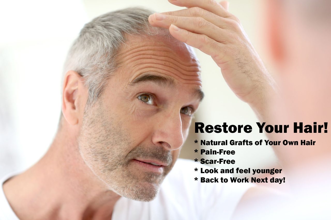 Neograft Hair Restoration Orange County