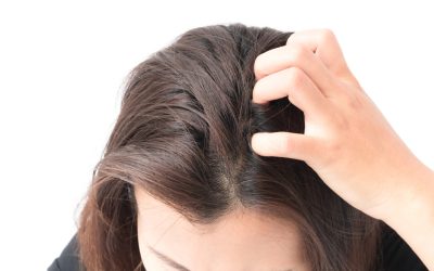Does Picking at Your Scalp Cause Hair Loss?