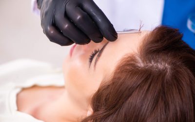 Can Women Have Hair Transplants?