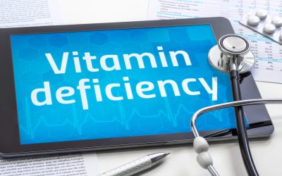 Which Vitamin Deficiency Causes Hair Loss?