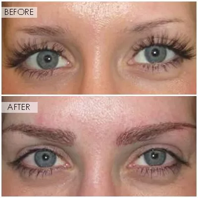 Orange County Hair Restoration