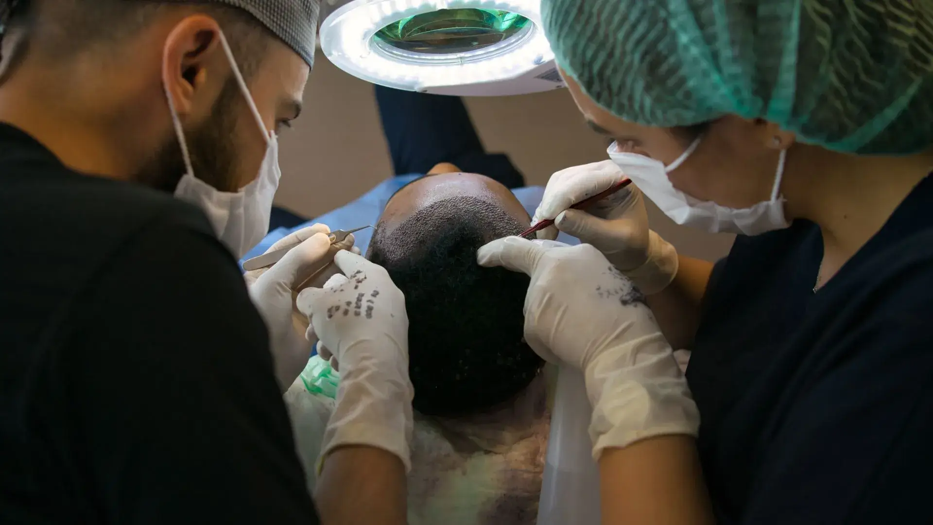 Hair-Restoration-Laguna-Niguel-CA Hair Restoration in Laguna Niguel, CA