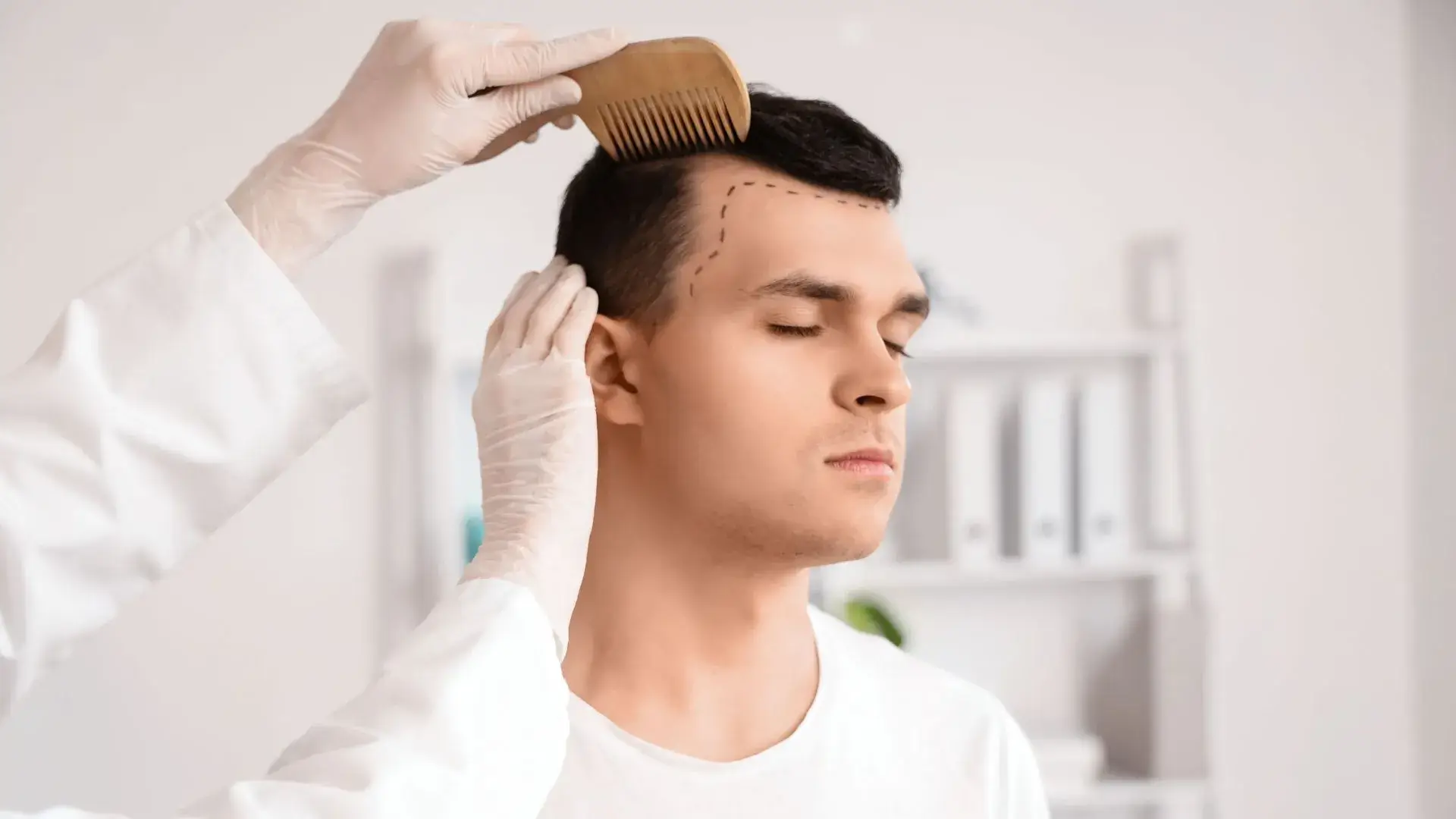 Hair Restoration in Fountain Valley, CA