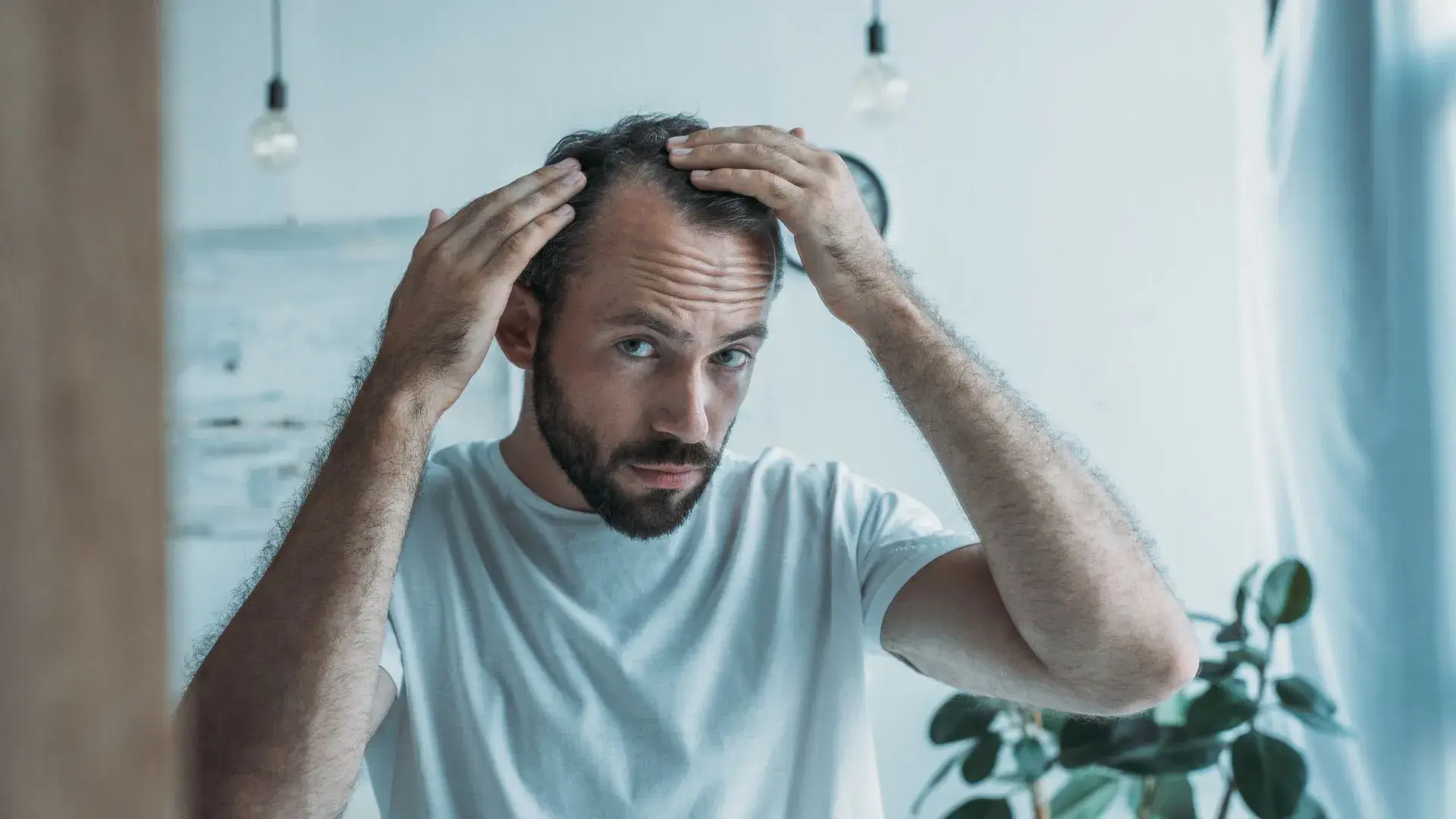Hair-Restoration-Garden-Grove-CA Hair Restoration in Garden Grove, CA