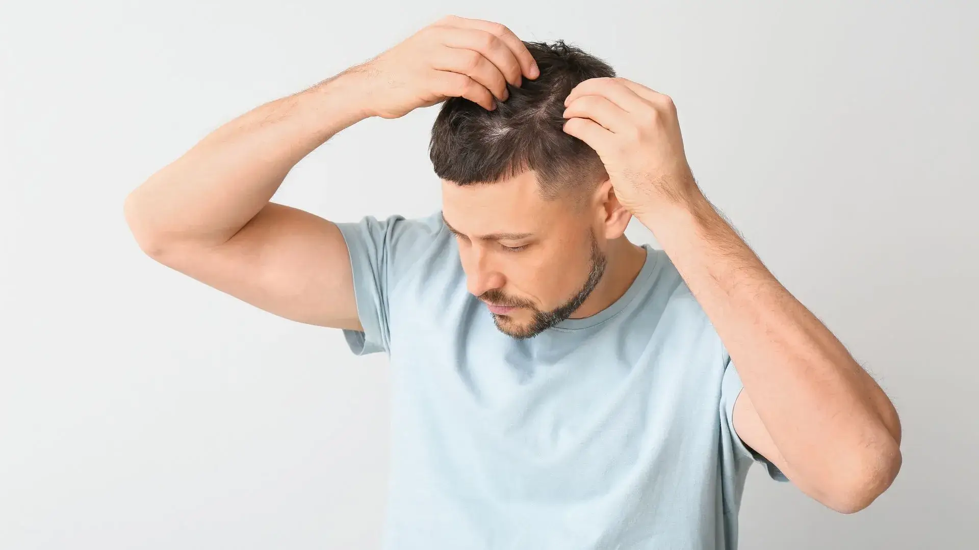Hair Restoration in Fullerton, CA