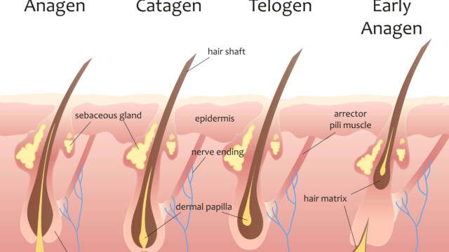 Treatment for thinning hair Treatment for thinning hair